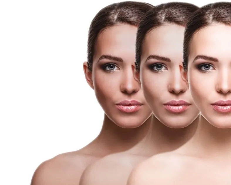 How to Decrease Melanin in Skin Naturally