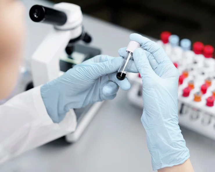 Gloved hands holding blood sample tube for laboratory test and medical analysis